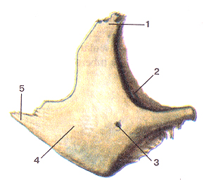 Скуловая кость (os zygomaticum), правая. Вид сбоку. 1-лобный отросток; 2-глазничная поверхность; 3-скуло-глазнич-ное отверстие; 4-латеральная поверхность; 5-височный отросток. Os zygomaticum. Правая. Вид сбоку. 1-processus frontalis; 2-facies orbitalis; 3-foramen zigomaticoorbitale; 4-facies lateralis; 5-processus temporalis. Right zygomatic bone. Lateral aspect. 1-frontal process; 2-orbital surface; 3-zygomaticoorbital foramen; 4-lateral surface; 5-temporal process.
